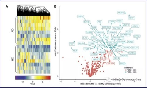 JACI – Olink 高敏微量体液蛋白质组与单细胞转录组共同助力开发特应性皮炎（AD）检测新方法