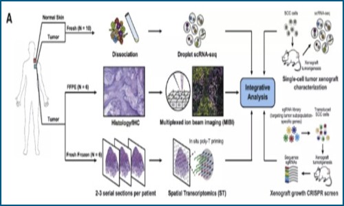 单细胞 + 空间转录组 | 多组学探究人鳞状上皮癌肿瘤微环境