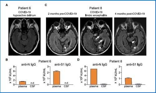 干货解读 |Olink 助力癌症患者感染 COVID-19 后引发神经障碍机制研究