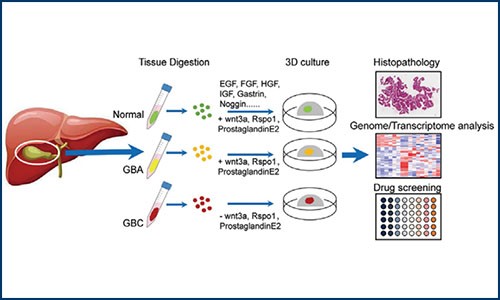 项目文章 | 九游平台官网单细胞测序分析助力类器官胆囊癌建模和药物筛选