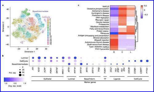 文献解读 | 单细胞测序研究人类前列腺癌