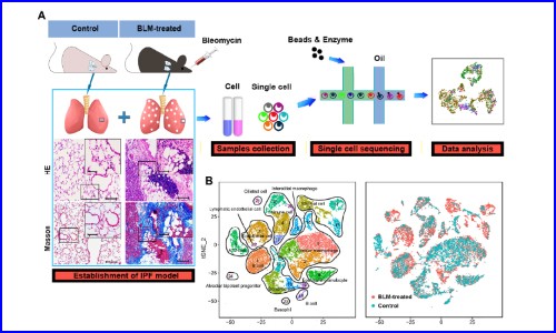 文献解读 | 单细胞 RNA 测序鉴定博莱霉素诱导的肺纤维化中内皮细胞的异质性