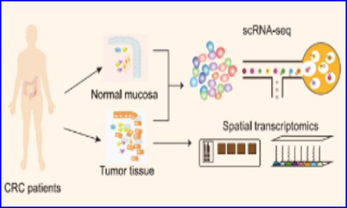 空转实验文章 NC- 上海免疫所苏冰 / 叶幼琼团队揭示结直肠癌肿瘤边界间质细胞与巨噬细胞互作模式