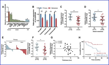 项目文章 | 九游平台官网 circRNA 测序助力在肢端和皮肤黑色素瘤的转移中发挥重要作用的调控因子 --circZNF609