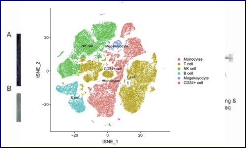 项目文章 | 单细胞 RNA 测序揭示急性心肌梗死的循环免疫图谱