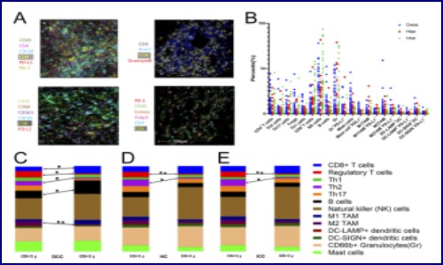 文献解读 | 胆管癌的免疫细胞图谱揭示不同的肿瘤微环境和相关预后的关系