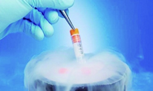 单细胞全长转录本测序 | 样品的选择与实验细节