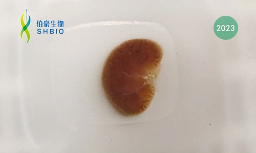 样本指南 |FFPE 样本空转送样指南