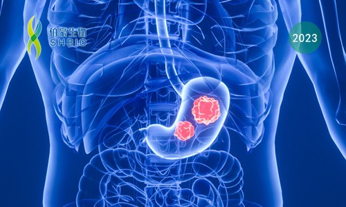 文献解读 | 胃癌患者免疫细胞的单细胞转录组测序