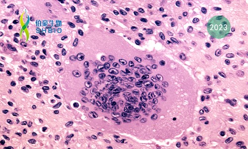 文献解读 | 单细胞分辨率下破骨细胞形成过程