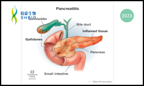 新文速递 |Olink 蛋白组学助力贝勒医学院大型前瞻性胰腺炎血清免疫谱新发现