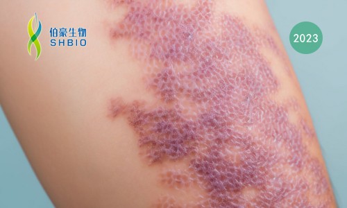 多组学联合文章速递 | 空间转录组 + 单细胞 + 蛋白组学共同揭示特应性皮炎中复杂的炎症细胞网络