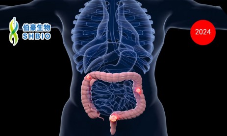 文献解读 | 单细胞转录组学分析揭示结直肠癌中异质性肿瘤干细胞样细胞及其器官特异性转移特征