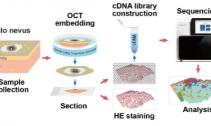 项目文章 | 晕痣黑色素细胞代谢异常与树突状细胞活化有关