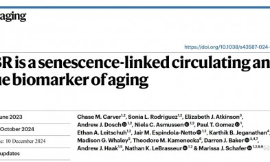 Nature Aging|Olink 蛋白组学助力发现延缓衰老新型组织相关蛋白标志物
